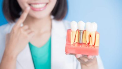 Dental Implant Cost in Korea: Everything You Need to Know Before Getting One