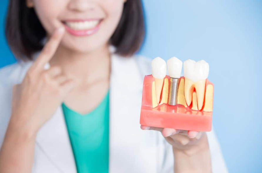 Dental Implant Cost in Korea: Everything You Need to Know Before Getting One